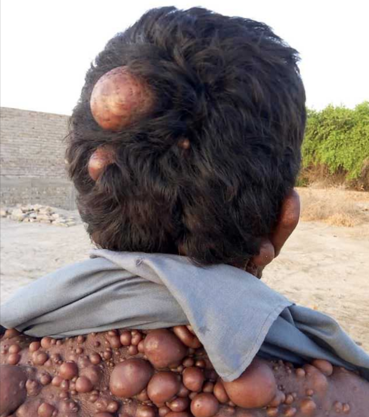 Onu gören yolunu değiştiriyor: 'Ailemi utandırmamak için...' G3