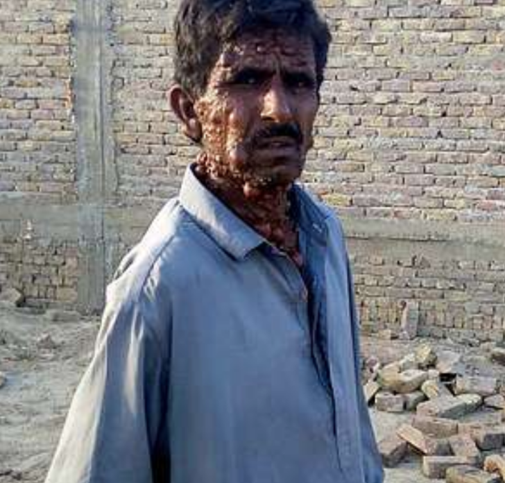 Onu gören yolunu değiştiriyor: 'Ailemi utandırmamak için...' G4