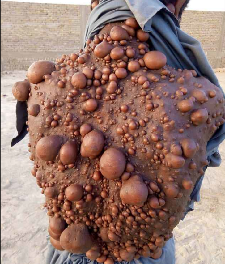 Onu gören yolunu değiştiriyor: 'Ailemi utandırmamak için...' G5