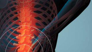 Romatizmal hastalıkların tedavisinde verimlilik hastanın elinde