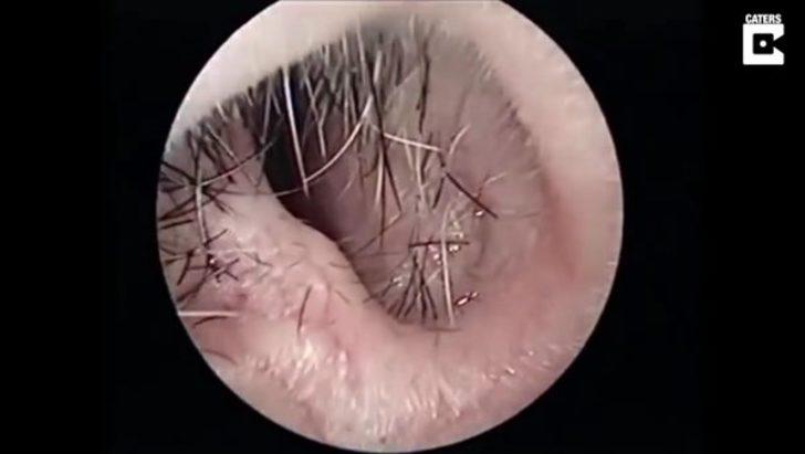 Burnundan çıkan şey şoke etti  G1