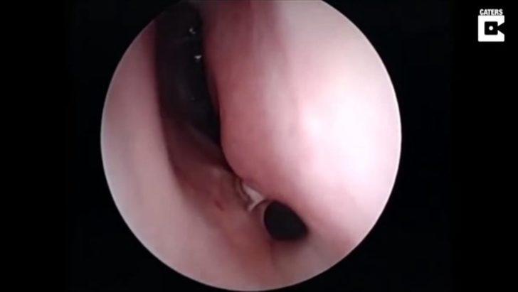 Burnundan çıkan şey şoke etti  G2