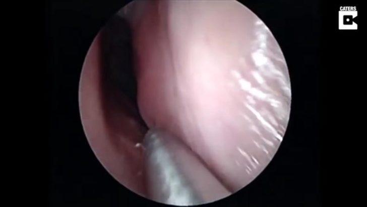 Burnundan çıkan şey şoke etti  G4