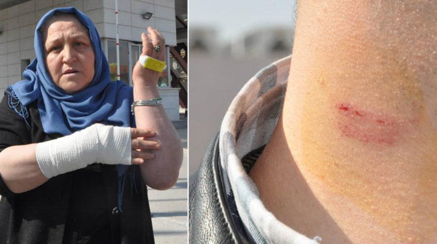 Hastaneyi karıştıran iddia: Doktor hastasını dövdü