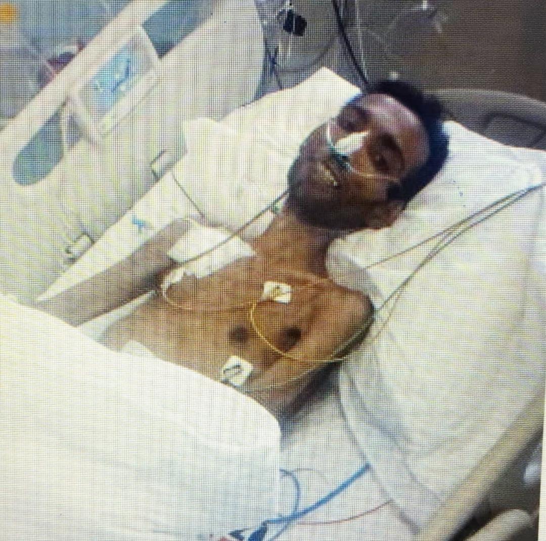 Poems sendromu sonu oluyordu! 29 kiloya kadar d&uuml;şt&uuml;, konuşamaz hale geldi ama...