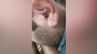 Kulağından çıkan doktoru bile şaşırttı