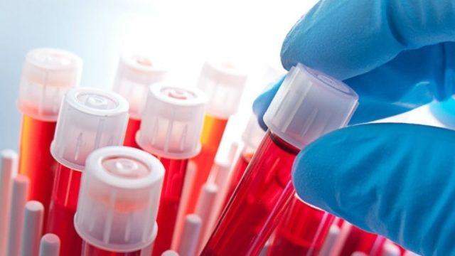 MCHC nedir? MCHC düşüklüğü ve yüksekliği ne anlama gelir? MCHC kan değeri nedir? 