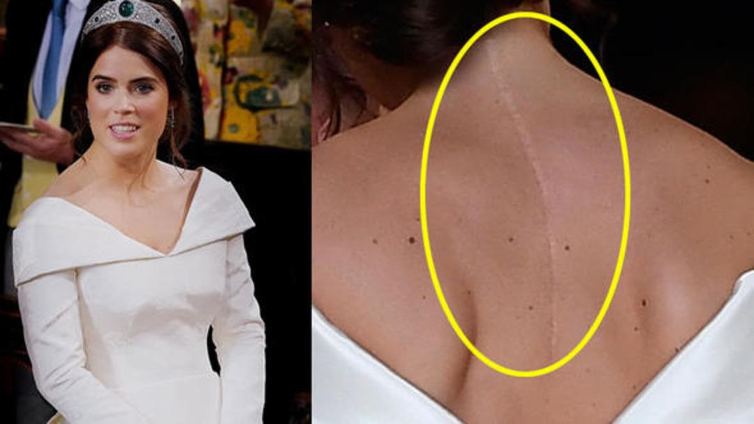 Kraliyet d&uuml;ğ&uuml;n&uuml;nde gelinlik şaşkınlığı! 