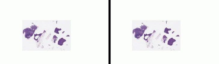 Google yapay zeka ile kanser teşhisinde doktorları gölgede bıraktı   G2