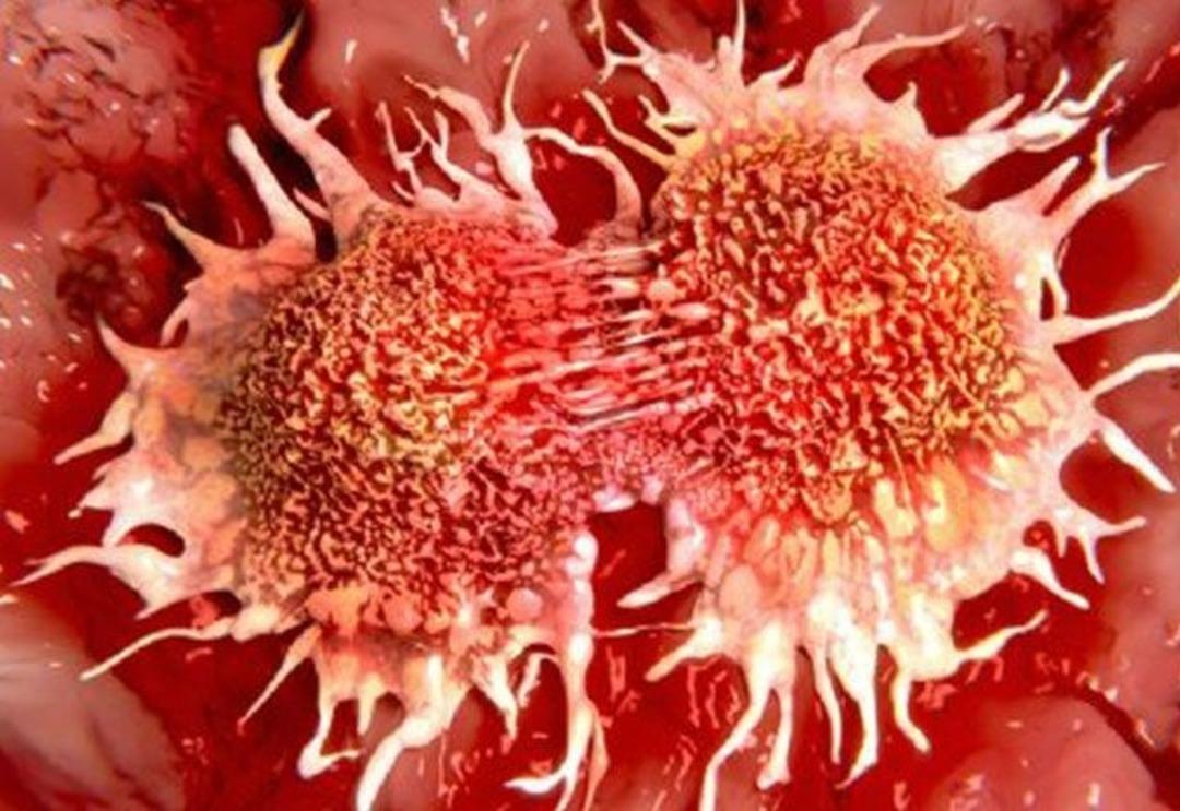 Google yapay zeka ile kanser teşhisinde doktorları g&ouml;lgede bıraktı  