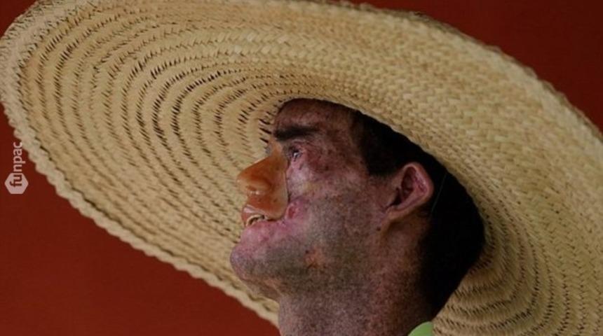 Bu hastalığı daha &ouml;nce hi&ccedil; duymadınız! (15 Fotoğraf)