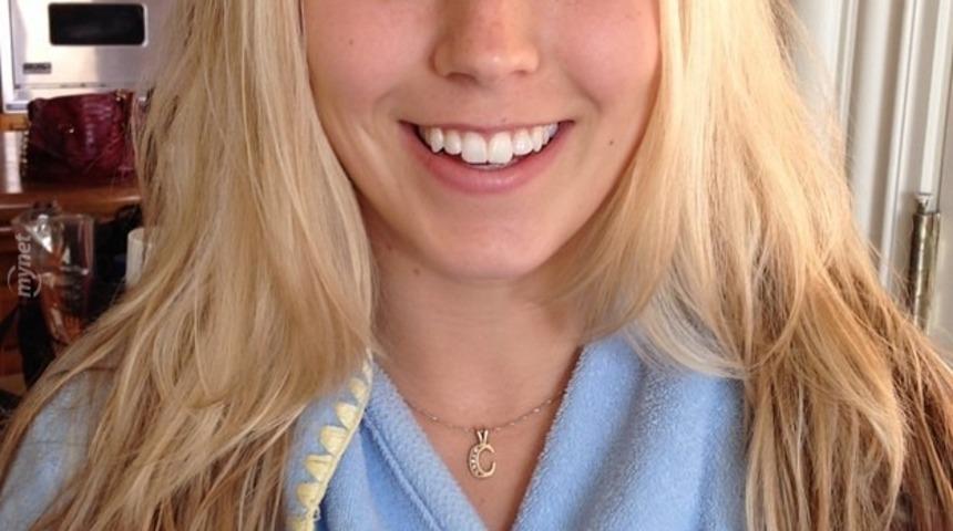 &Ouml;ncesi ve Sonrasıyla Y&uuml;z&uuml;n&uuml;n Değiştiğine İnanmayacağınız 7 Kadın