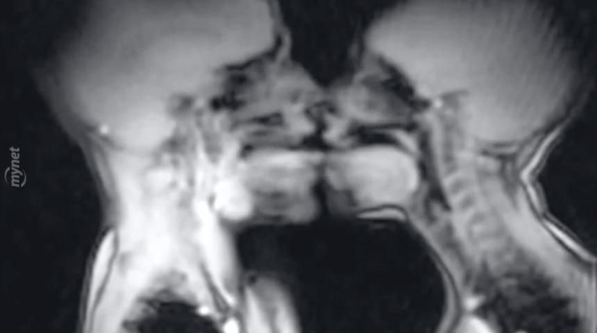 Bir Seks Anı Nasıl R&ouml;ntgenlenir?