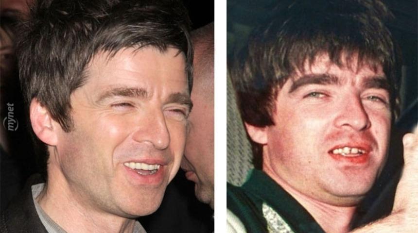 &Ouml;ncesi ve Sonrasıyla &Ccedil;irkinlik Abidesi 9 &Uuml;nl&uuml;!