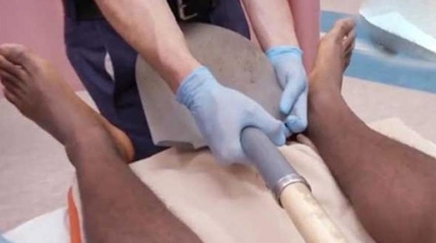 Şanssızlığın Böylesi Görülmedi: Hem Damdan Düştü Hem de Makatına Kürek Sapı Girdi