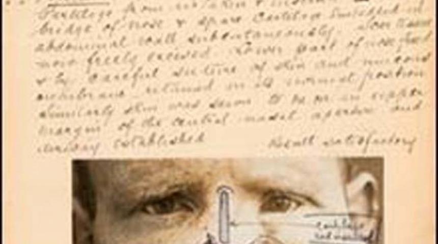 D&uuml;nyanın İlk Estetik Ameliyatları Hakkında Neler Biliyorsunuz?