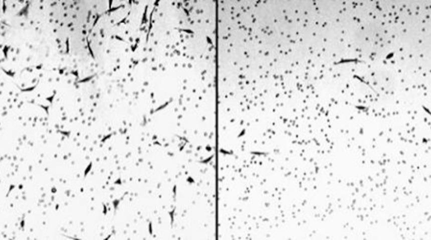 Kenevir Yağının Kanser H&uuml;crelerini Nasıl &Ouml;ld&uuml;rd&uuml;ğ&uuml;n&uuml; G&ouml;steren Videoyu İzlemelisiniz