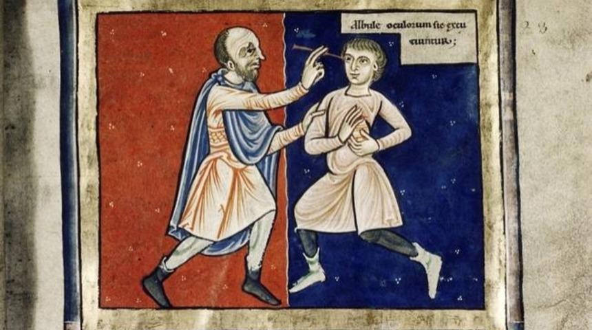 Sizi Modern &Ccedil;ağlarda Yaşadığınıza Ş&uuml;krettirecek 6 Orta&ccedil;ağ Tedavisi