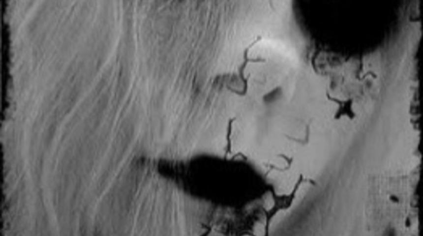 Kulağa &Ccedil;ok Sa&ccedil;ma Gelen 5 Fobi