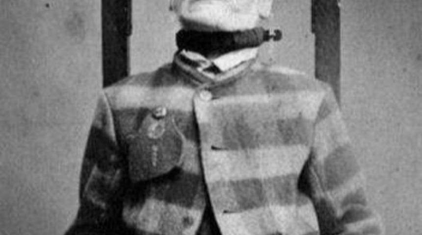 Ger&ccedil;ek Akıl Hastahanelerinden Akıl Almaz 13 Kare