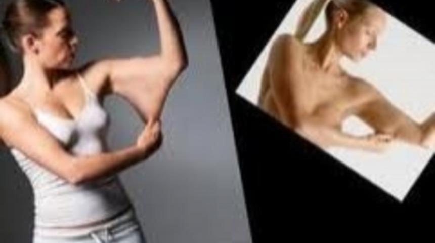 Bayanlarda Koltuk Altı Arkası Sarkmaları