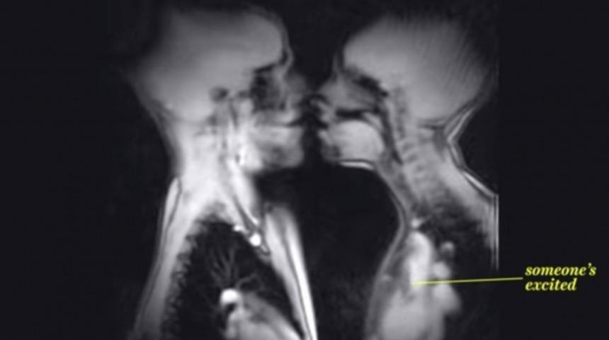 MRI Altında Konuşma, Yutkunma, Öpüşme ve Seks Nasıl Gözükür? (+18)