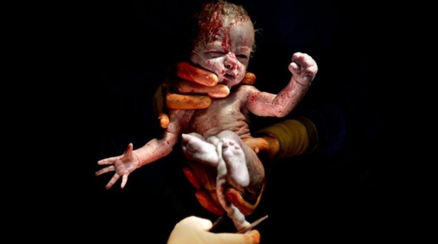 Doğduğu Andan Saniyeler Sonra Fotoğrafı &Ccedil;ekilen 10 Bebek