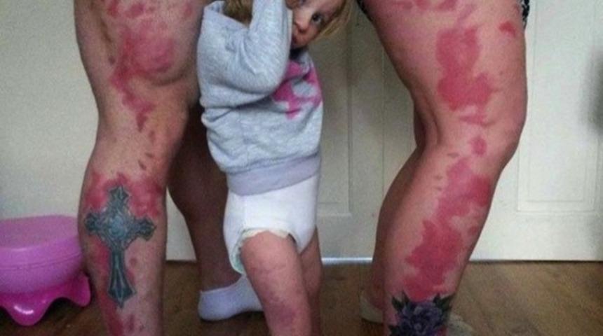 Çocuklarında Doğum Lekesi Var Diye Doğum Lekesi Şeklinde Dövme Yaptıran Muhteşem Aile