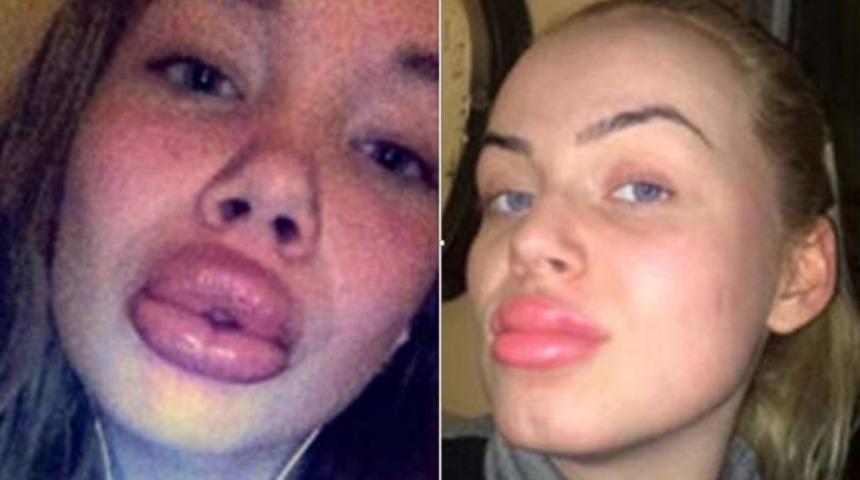 Seksi Dudaklara Kavuşayım Derken Maymun Poposuna D&ouml;nmeyin