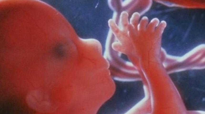 Down Sendromu'nun Belirlenmesi İçin Kan Testi