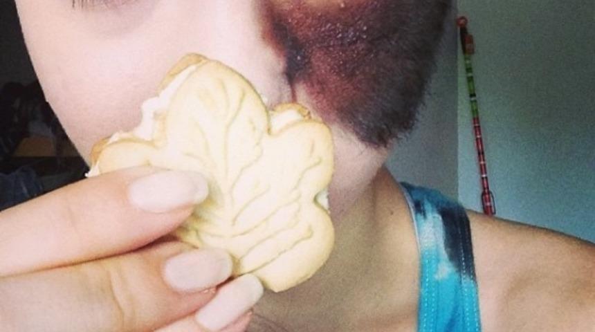 Doğum Lekesi ile Doğan Cesur Kızın &Ouml;yk&uuml;s&uuml;