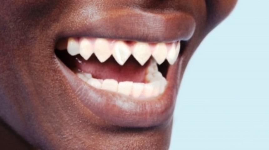 İnanamayacağınız 20 Vücut Modifikasyonu Türü