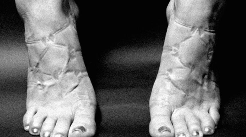 Çorap Lastiği İzlerini Fotoğraflayan Sanatçıdan 10 İlginç Kare