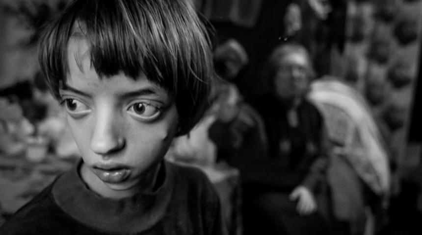 1986 Yılında N&uuml;kleer Patlama Sonucu &Ccedil;ocukluklarından Olanların 16 Fotoğraf Karesi! 