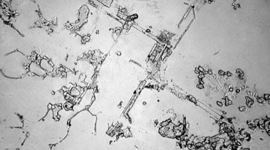 Farklı Duyguların Farklı G&ouml;zyaşları Mikroskop Altında Nasıl G&ouml;r&uuml;n&uuml;yor?