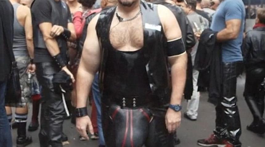 Bu Adamın Penisi 4.3 Kilogram!