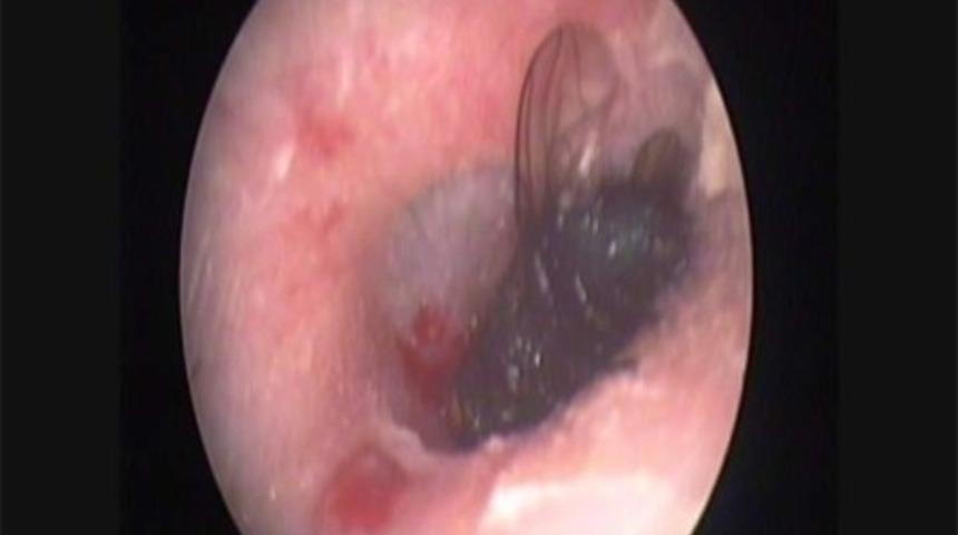 Tıpta G&ouml;r&uuml;len İnanılmaz Vakalar