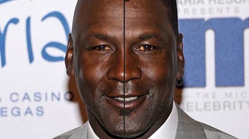 Öncesi Ve Sonrasıyla Kel Dünya Starlarının Ya Saçları Olsaydı? 