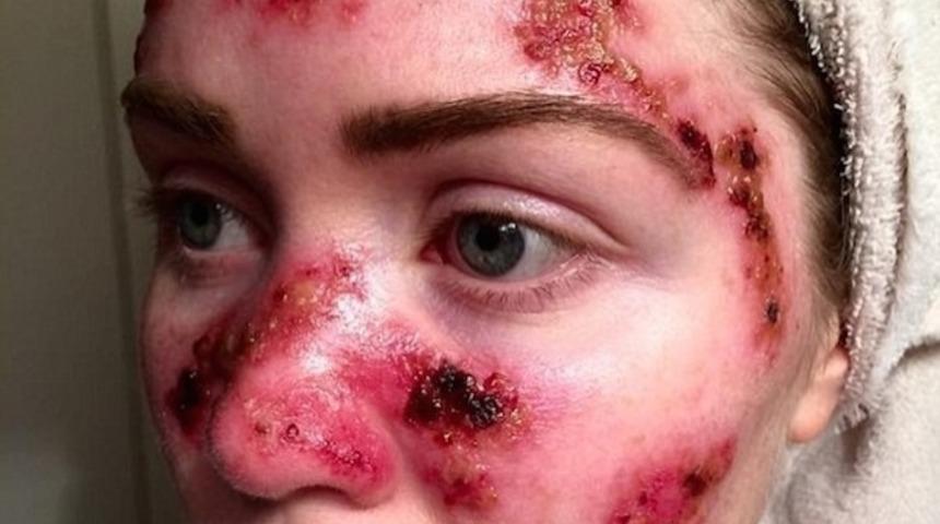 Solaryuma Gitmeden &Ouml;nce Dikkat Edin!