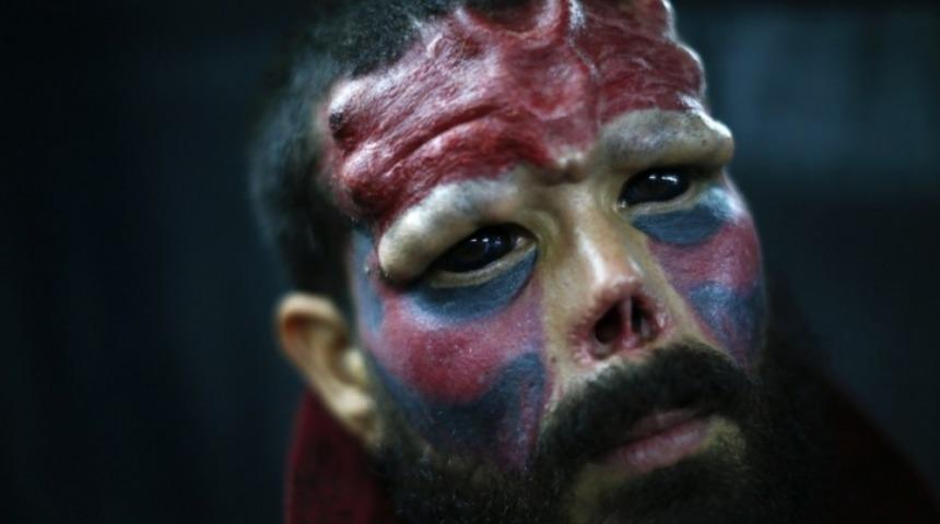 &Uuml;nl&uuml;lere Benzemek İ&ccedil;in Yaptırdıkları Estetik Operasyonlara İnanamayacağınız 9 Rahatsız İnsan