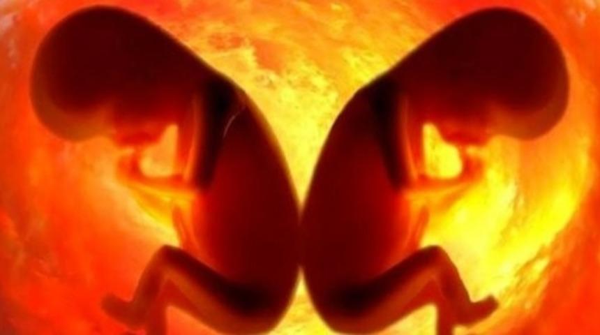 İkizler Ama Babaları Farklı