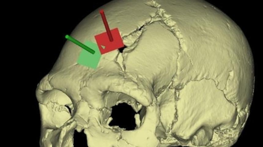 İnsanın İnsana Şiddetinin 430 Bin Yıllık İzi