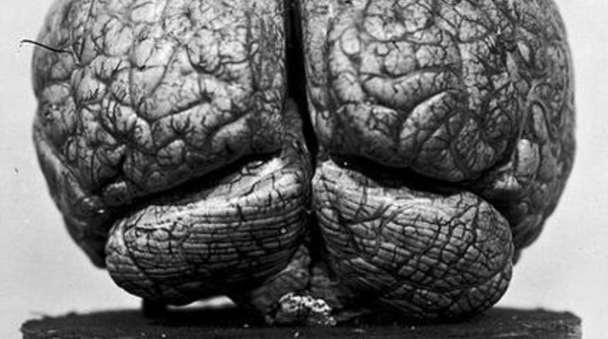 D&uuml;nyaca &Uuml;nl&uuml; Doktorun Fotoğraf Arşivinden Korkun&ccedil; G&ouml;r&uuml;nt&uuml;ler