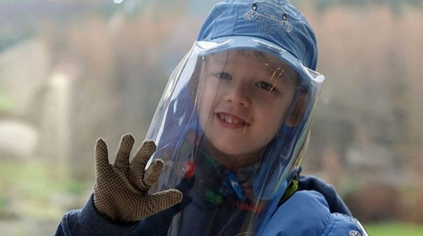 &Ccedil;ok Nadir G&ouml;r&uuml;len Birbirinden İlgin&ccedil; 12  Hastalık