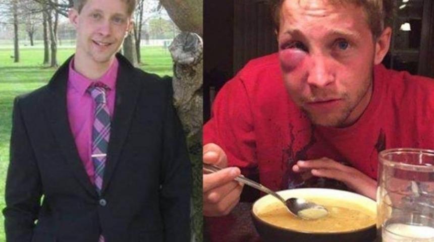 Asperger Sendromlu Gen&ccedil; Kendisine Saldıranlara &Ouml;nemli Bir Ders Verdi