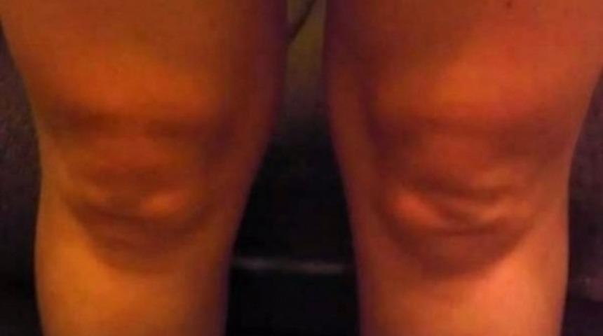 Ekstra Tatil G&uuml;n&uuml;nde Ekstra Y&uuml;z İfadelerine B&uuml;r&uuml;nen 10 Diz Kapağı