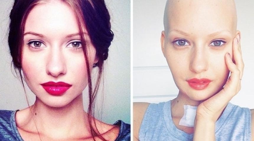 Kansere Yakalanan Hamile Model Bakın Ne Yaptı