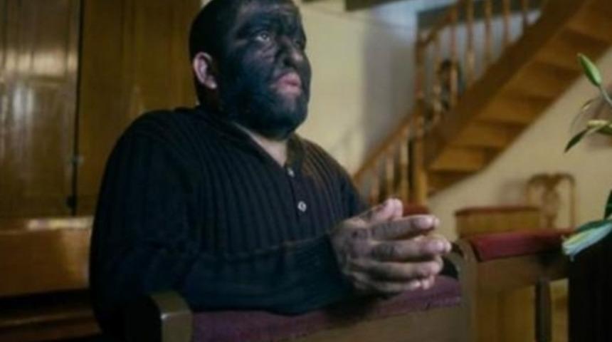 Bedenine Hapsolmuş Kurt Adam'ın Öyküsü