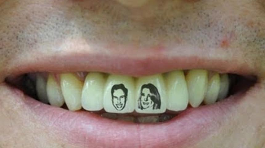Bir Bu Eksikti! Dişlere D&ouml;vme Modası Başladı