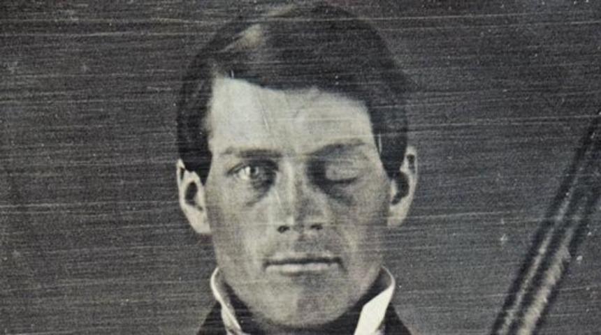 Akıl Sır Erdiremeyeceğiniz Bir Hayatta Kalma Hikayesi: Phineas Gage